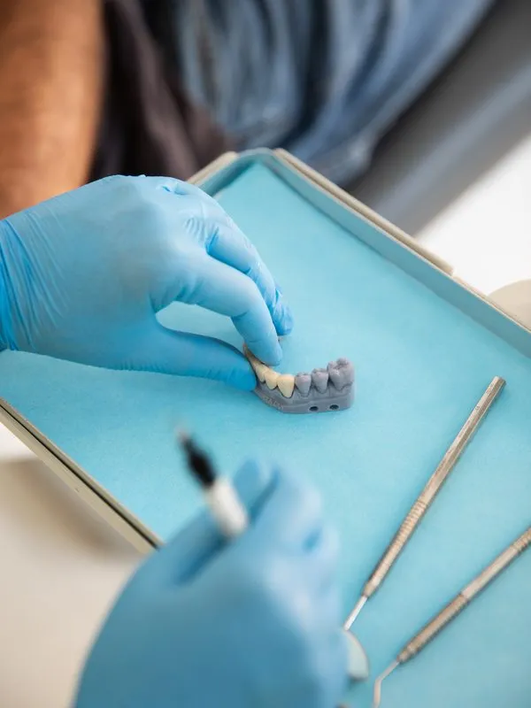 Prótesis dental