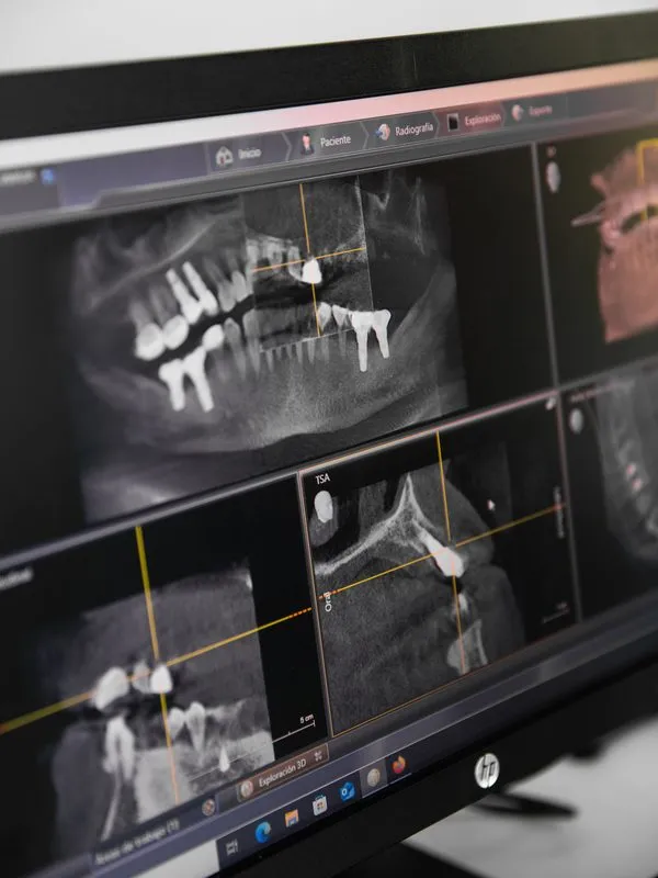Radiología dental
